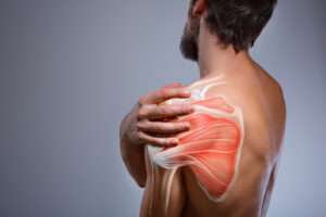 frozen shoulder